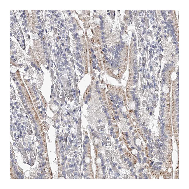 Atlas Antibodies Anti-NT5DC1 Antibody