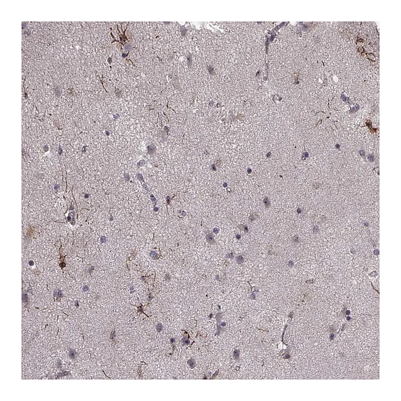 Atlas Antibodies Anti-NTF3 Antibody
