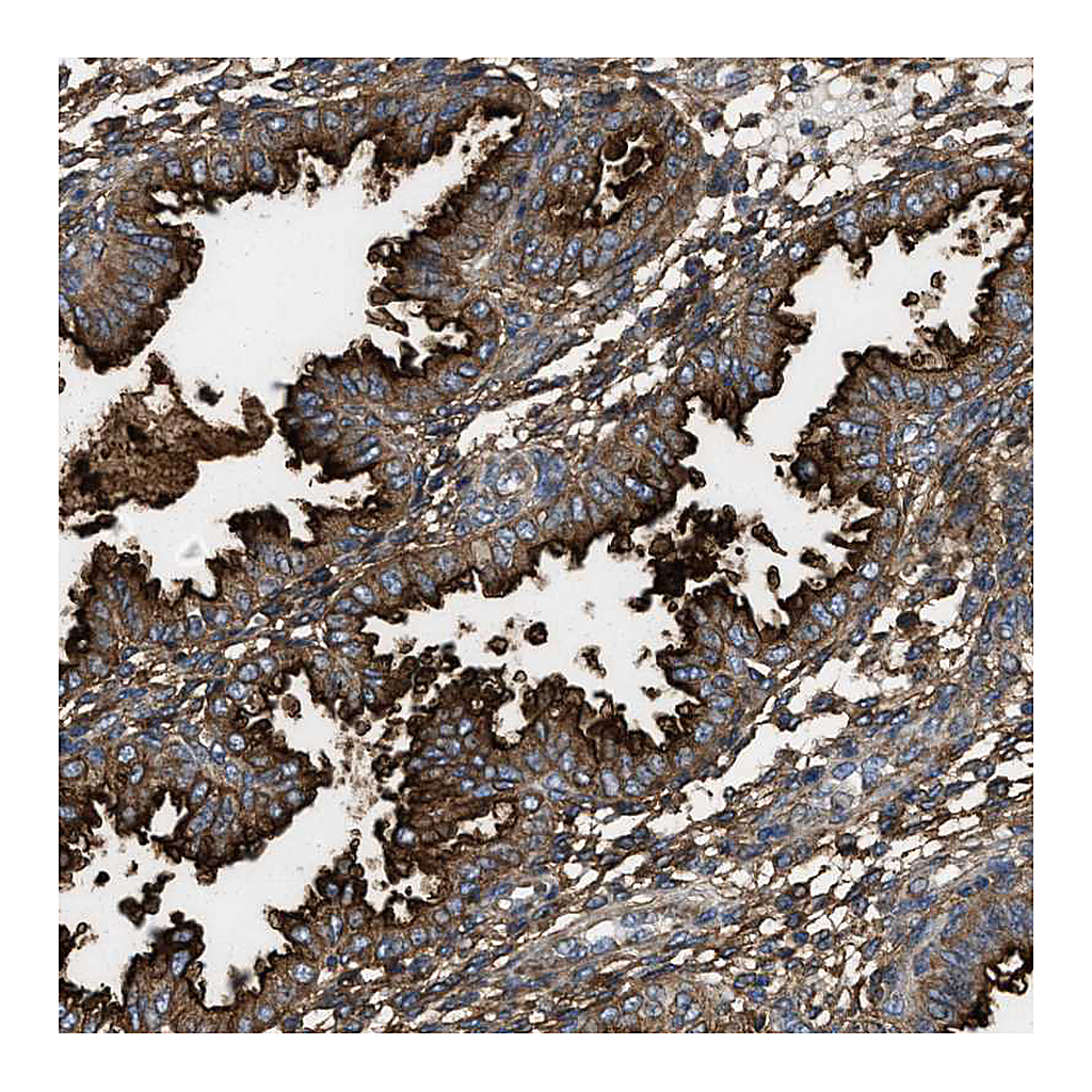 Atlas Antibodies Anti-NT5E Antibody