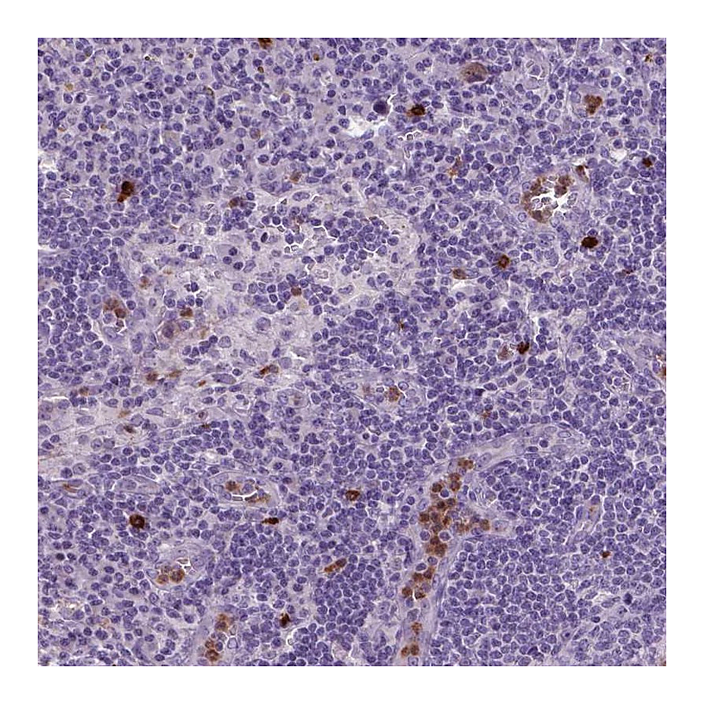 Atlas Antibodies Anti-NTNG2 Antibody