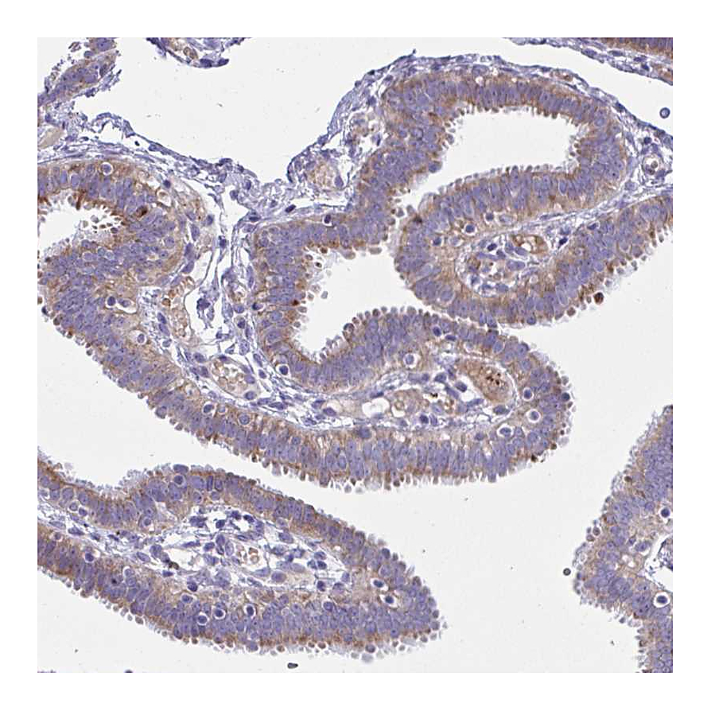 Atlas Antibodies Anti-NTN1 Antibody