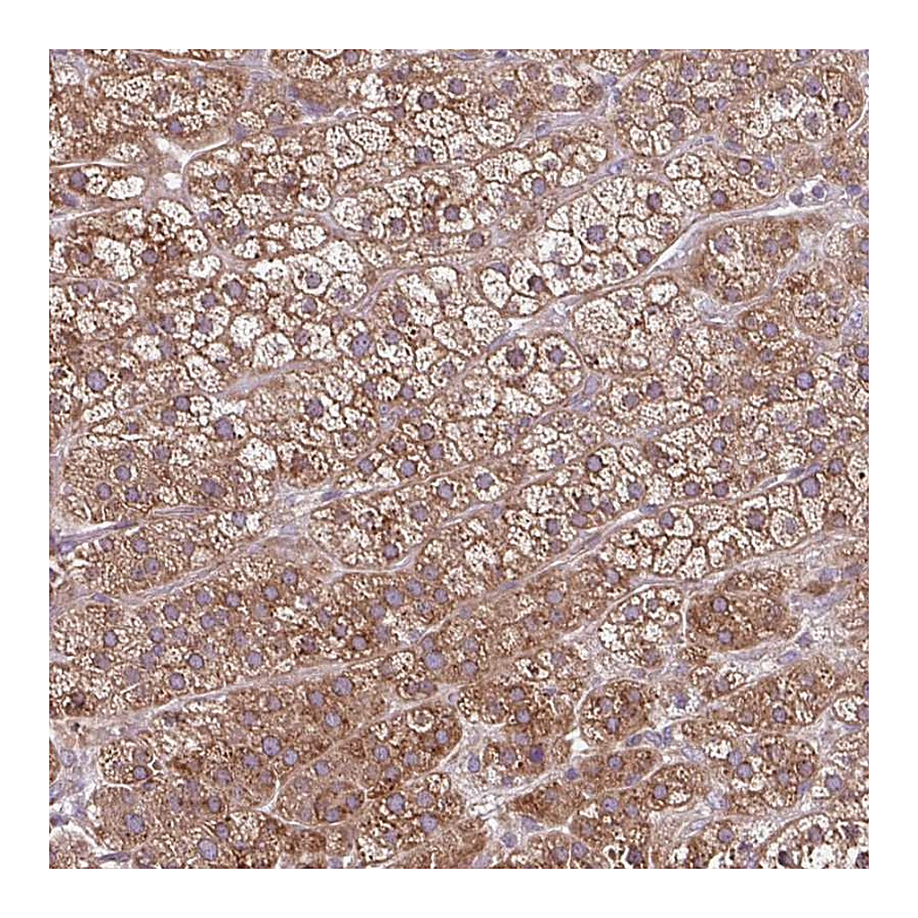 Atlas Antibodies Anti-NTPCR Antibody
