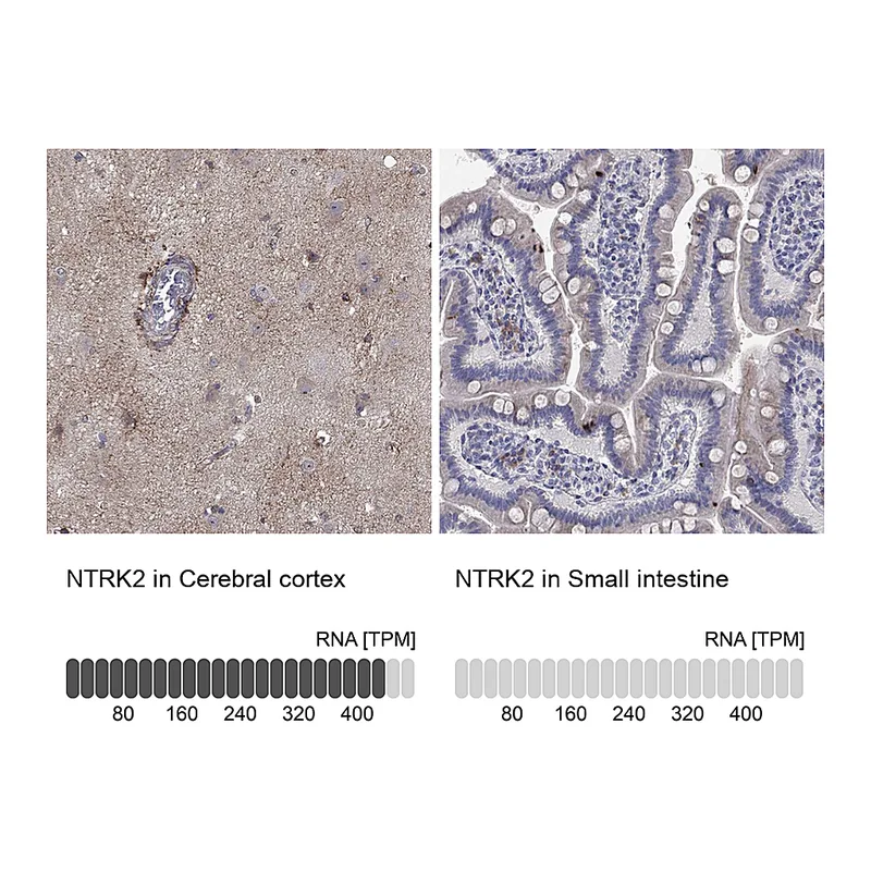 Atlas Antibodies Anti-NTRK2 Antibody