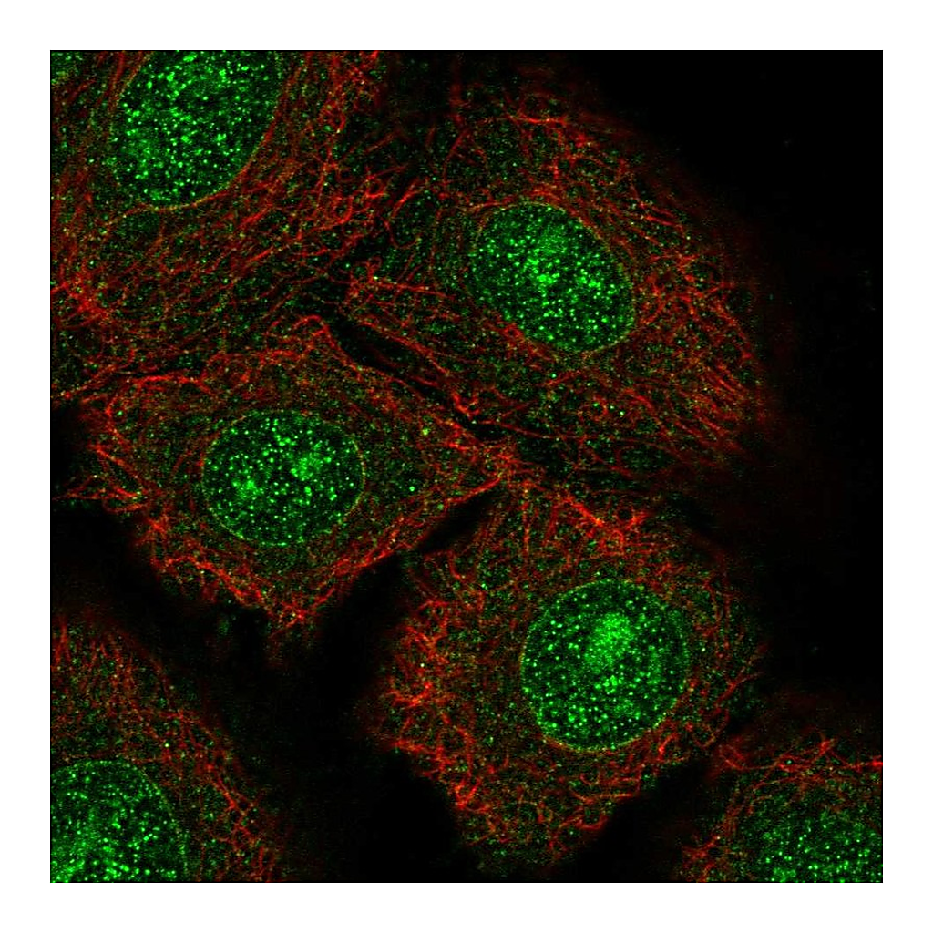 Atlas Antibodies Anti-NTRK3 Antibody