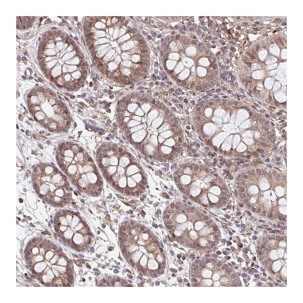 Atlas Antibodies Anti-NUB1 Antibody