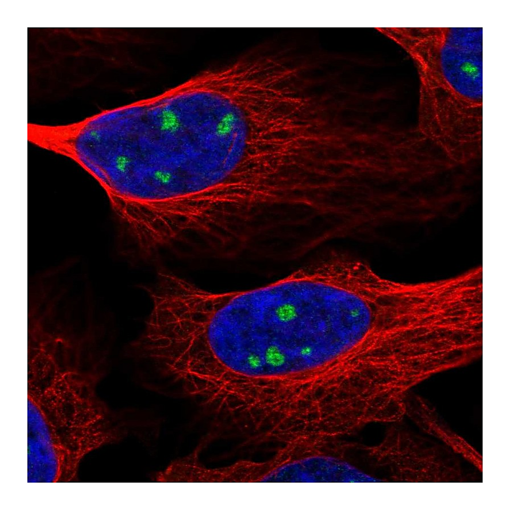 Atlas Antibodies Anti-NTRK3 Antibody
