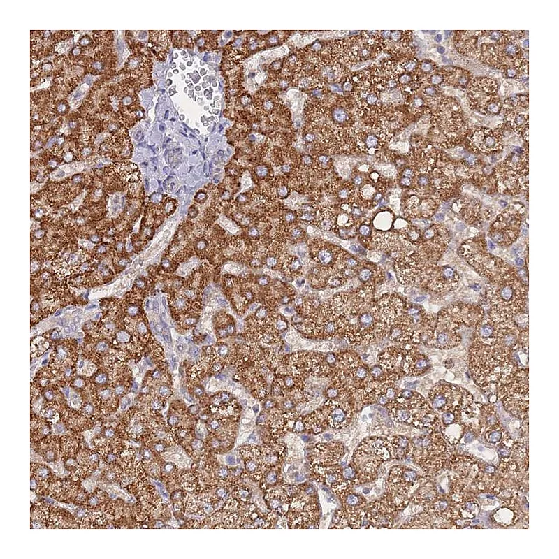 Atlas Antibodies Anti-NUB1 Antibody