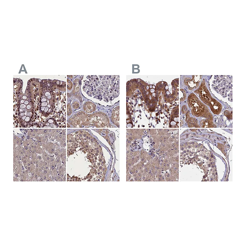 Atlas Antibodies Anti-NUBP1 Antibody