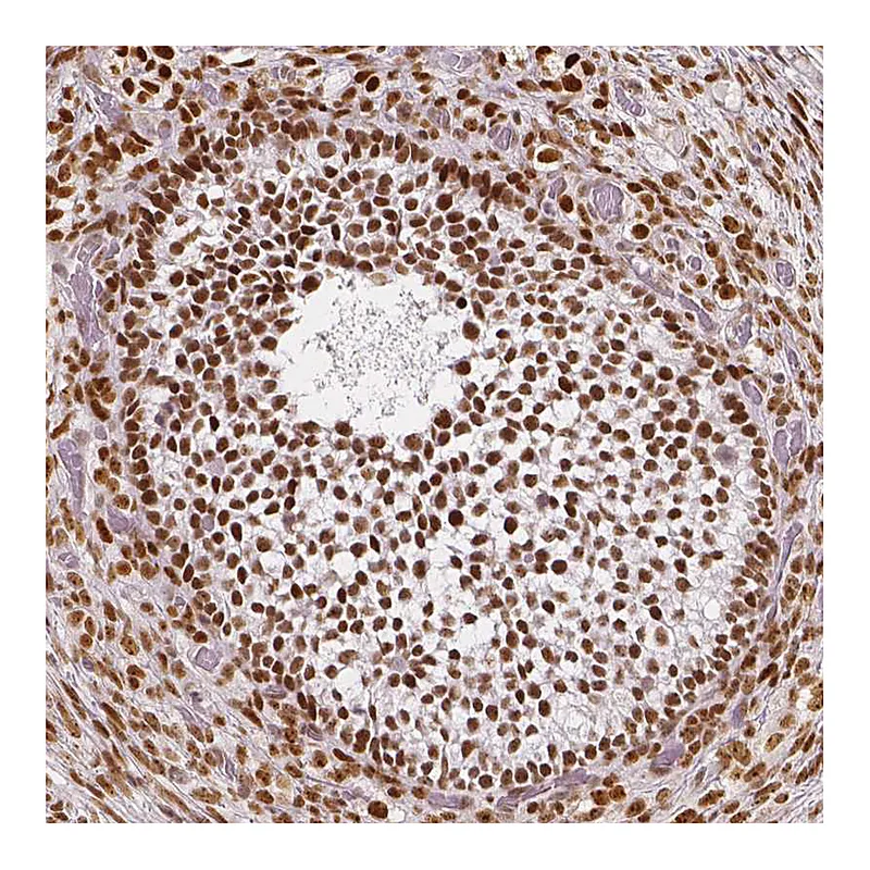 Atlas Antibodies Anti-NUCKS1 Antibody