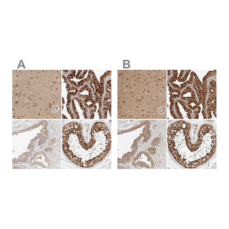 Atlas Antibodies Anti-NUDC Antibody