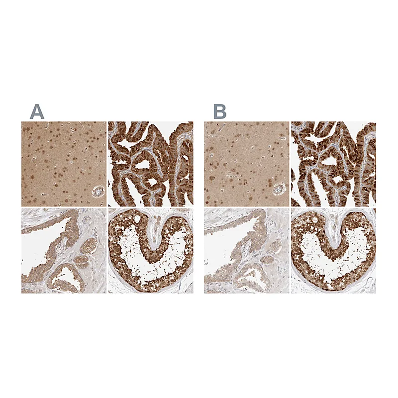 Atlas Antibodies Anti-NUDC Antibody