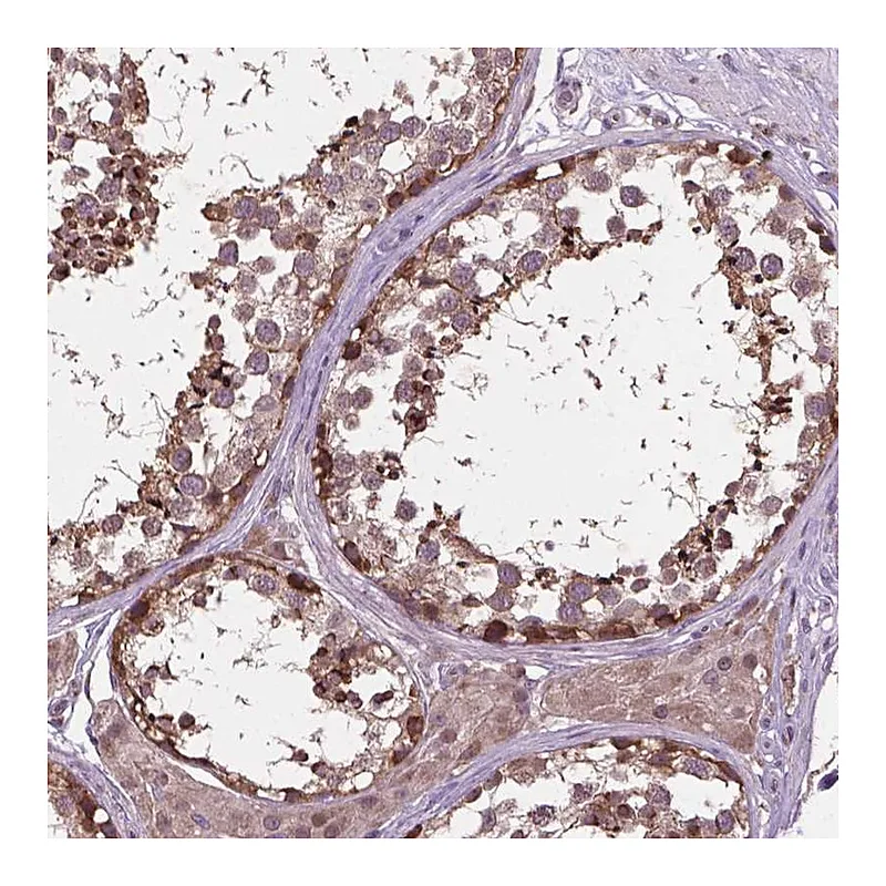 Atlas Antibodies Anti-NUDT1 Antibody