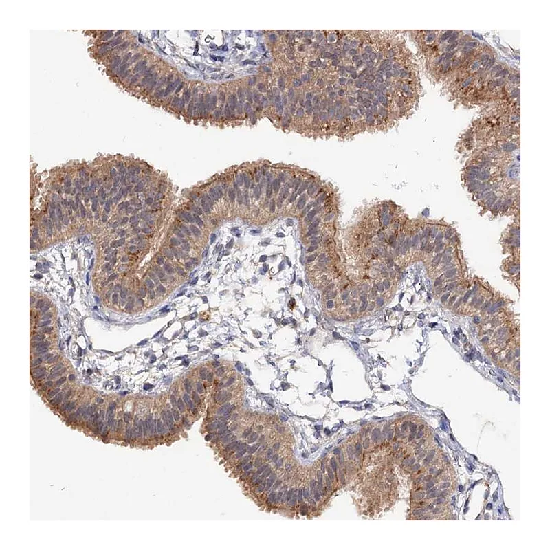 Atlas Antibodies Anti-NUDCD2 Antibody