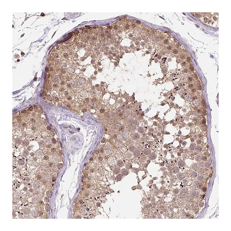 Atlas Antibodies Anti-NUDT10 Antibody
