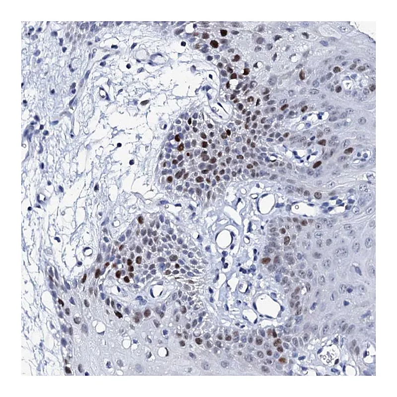 Atlas Antibodies Anti-NUDT13 Antibody