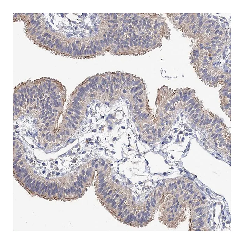 Atlas Antibodies Anti-NUDCD2 Antibody