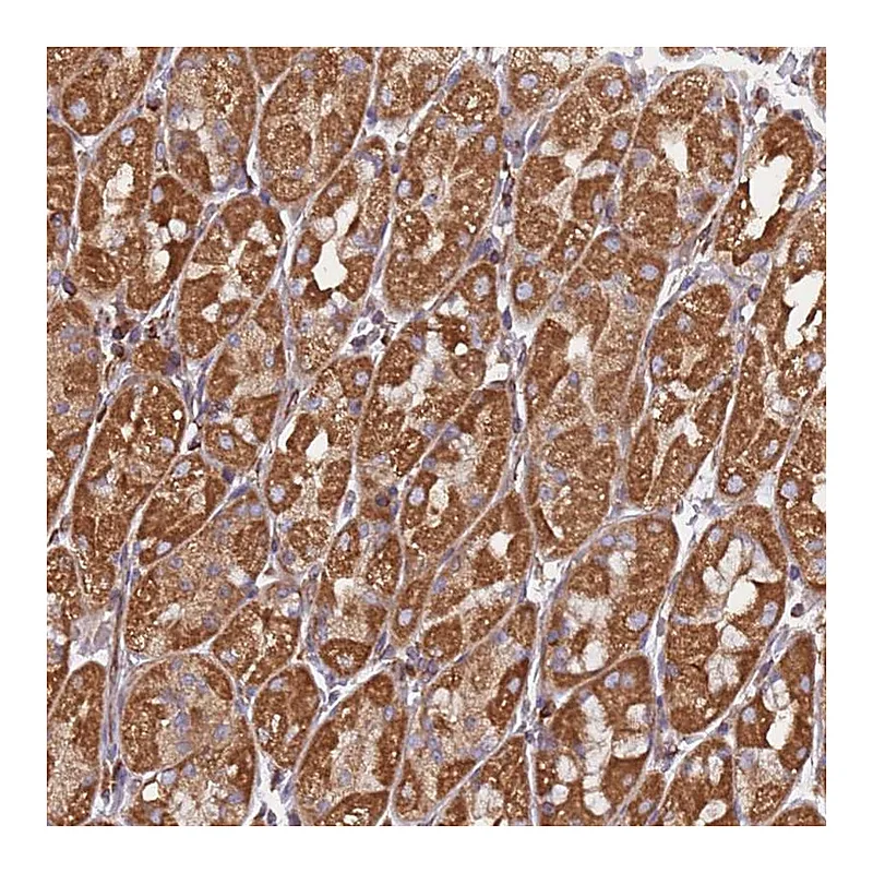 Atlas Antibodies Anti-NUDT12 Antibody