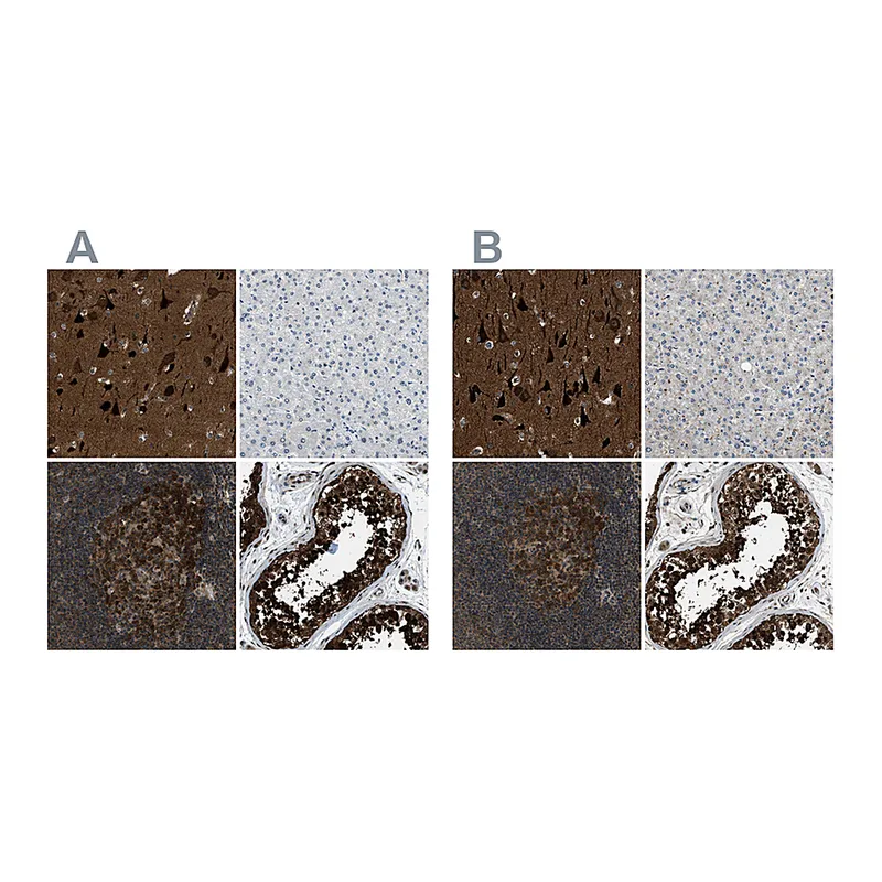 Atlas Antibodies Anti-NUDCD3 Antibody