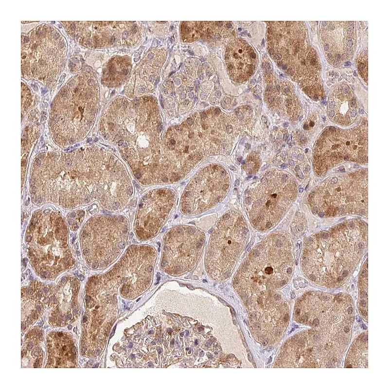 Atlas Antibodies Anti-NUDT16 Antibody
