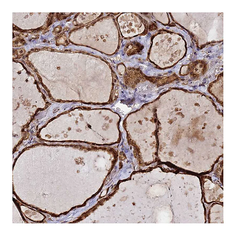 Atlas Antibodies Anti-NUDT14 Antibody