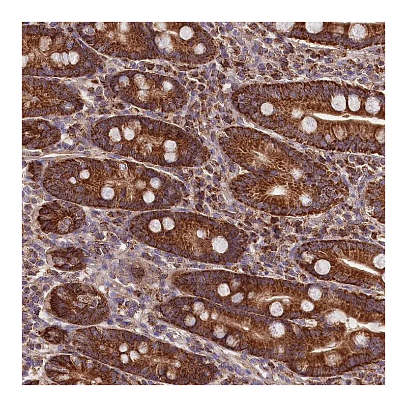 Atlas Antibodies Anti-NUDT15 Antibody