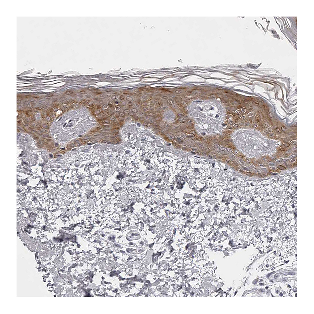Atlas Antibodies Anti-NUDT18 Antibody