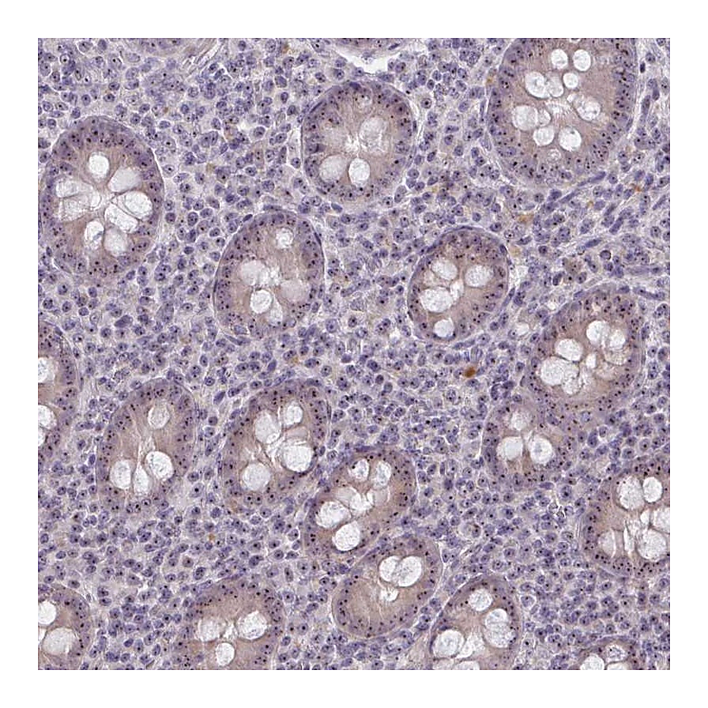Atlas Antibodies Anti-NUDT16 Antibody