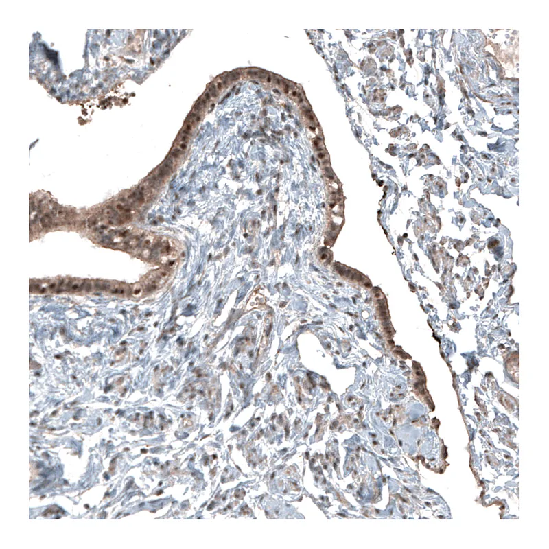 Atlas Antibodies Anti-NUDT16L1 Antibody