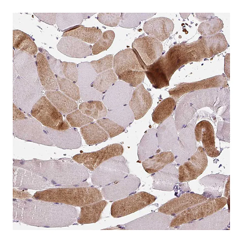 Atlas Antibodies Anti-NUDT3 Antibody