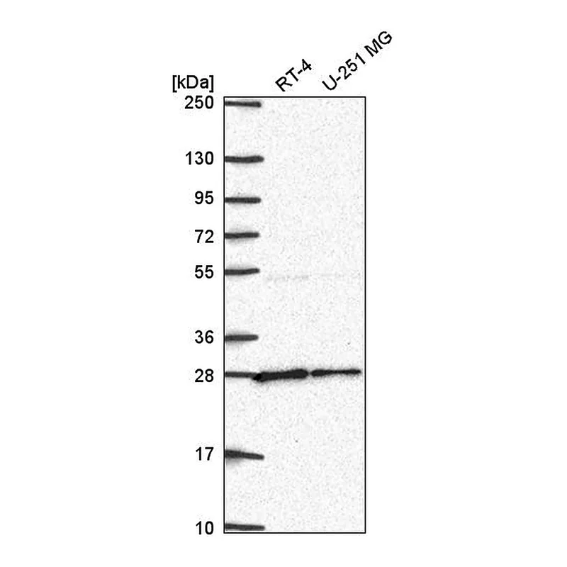 Atlas Antibodies Anti-NUDT21 Antibody