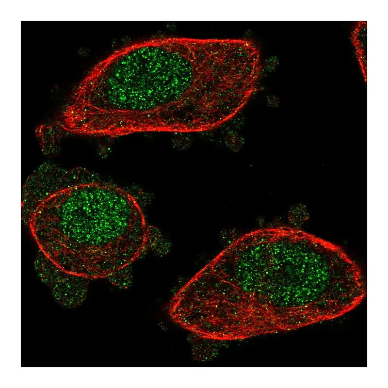 Atlas Antibodies Anti-NUDT2 Antibody
