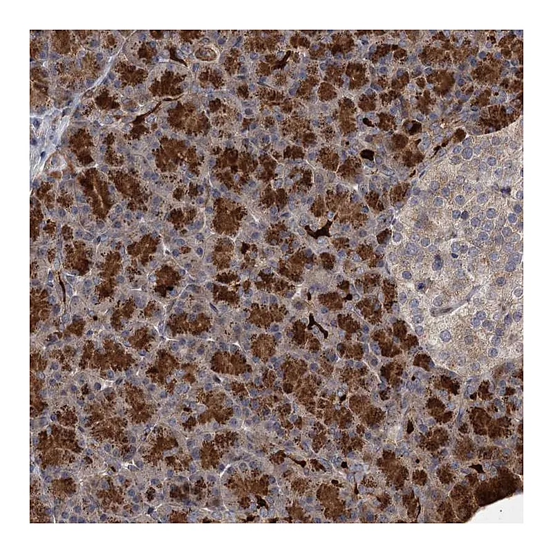 Atlas Antibodies Anti-NUDT22 Antibody