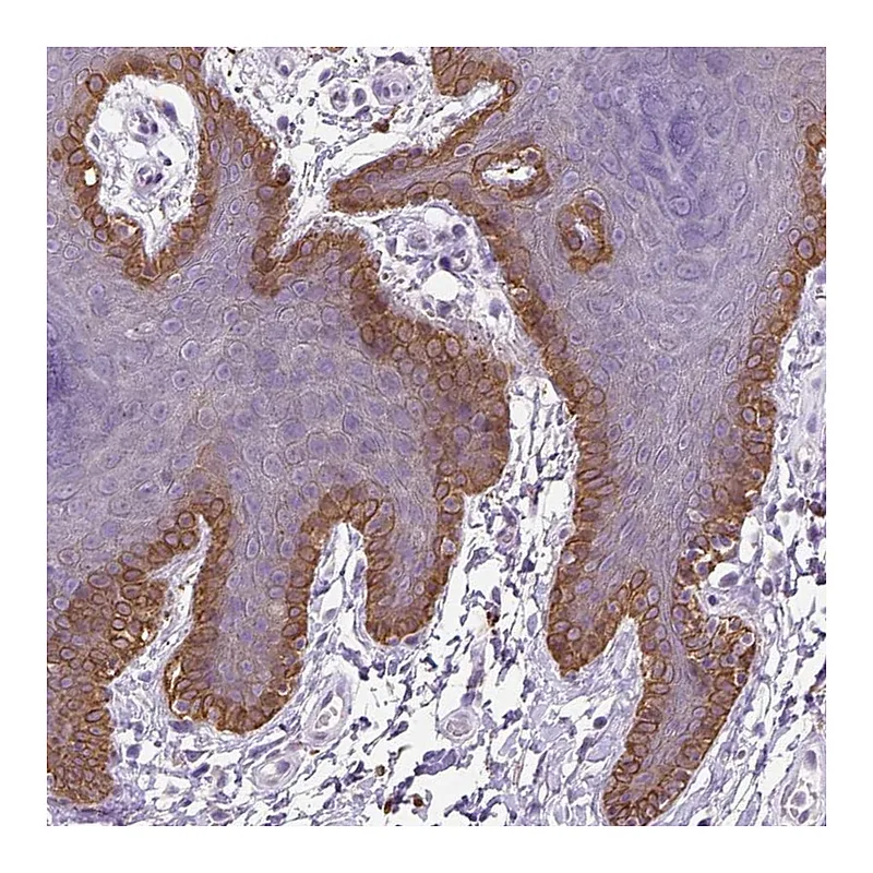 Atlas Antibodies Anti-NUDT2 Antibody