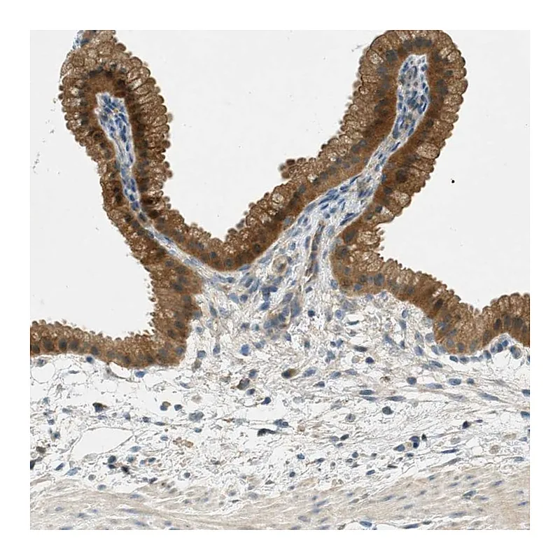 Atlas Antibodies Anti-NUDT4 Antibody