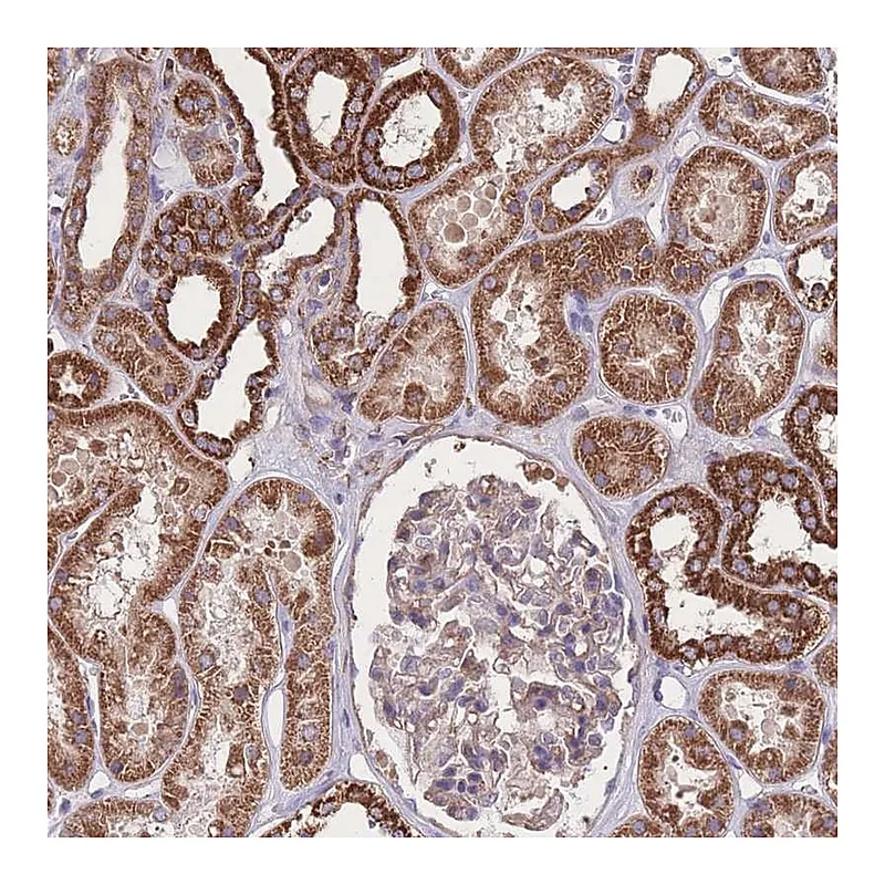 Atlas Antibodies Anti-NUDT21 Antibody