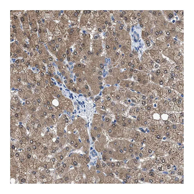 Atlas Antibodies Anti-NUDT5 Antibody