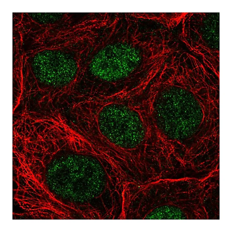 Atlas Antibodies Anti-NUDT22 Antibody