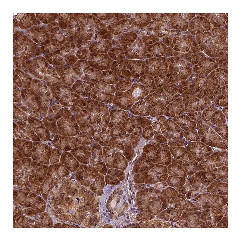 Atlas Antibodies Anti-NUDT9 Antibody