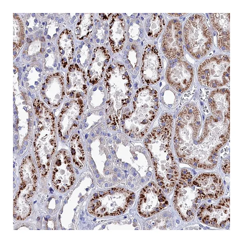 Atlas Antibodies Anti-NUDT7 Antibody