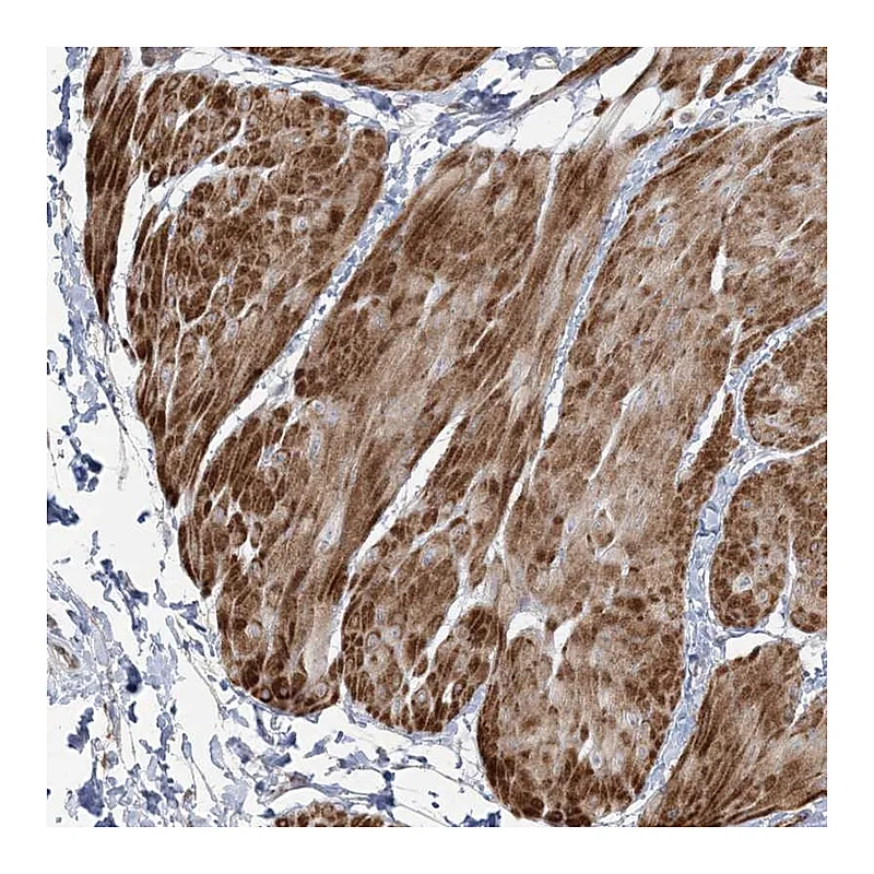 Atlas Antibodies Anti-NUDT9 Antibody