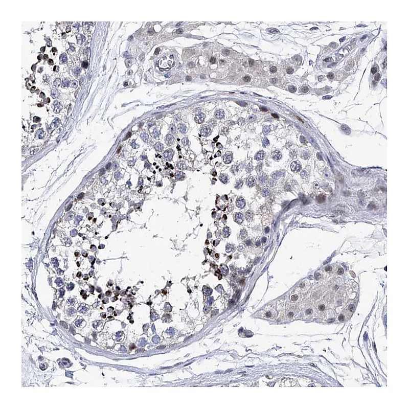 Atlas Antibodies Anti-NUFIP1 Antibody