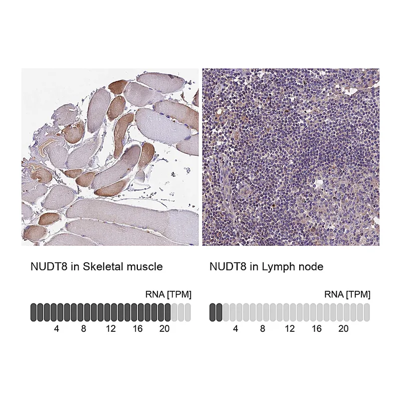 Atlas Antibodies Anti-NUDT8 Antibody
