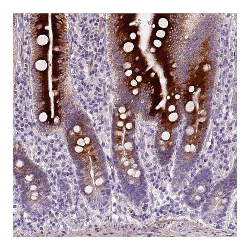 Atlas Antibodies Anti-NUDT6 Antibody