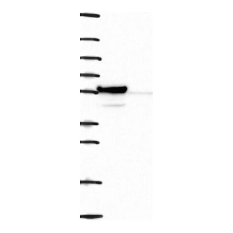 Atlas Antibodies Anti-NUF2 Antibody