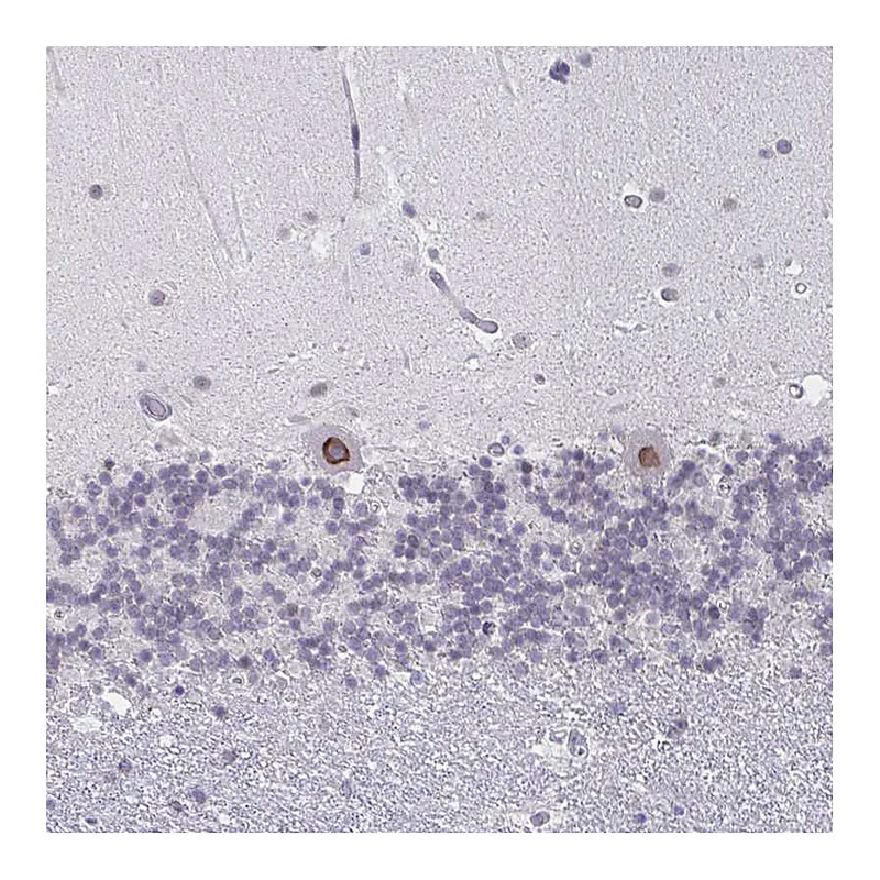 Atlas Antibodies Anti-NUP133 Antibody