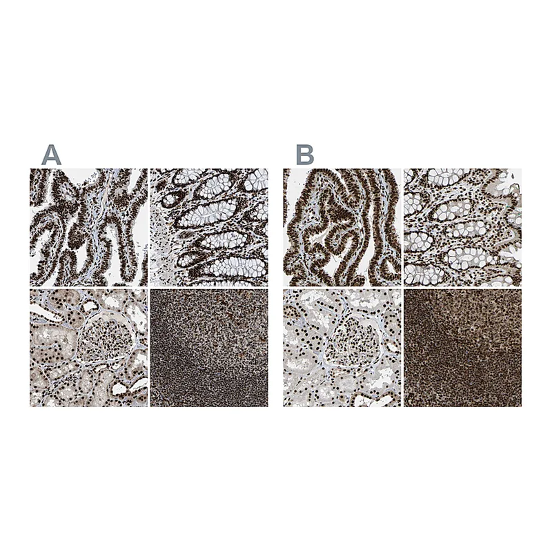Atlas Antibodies Anti-NUMA1 Antibody