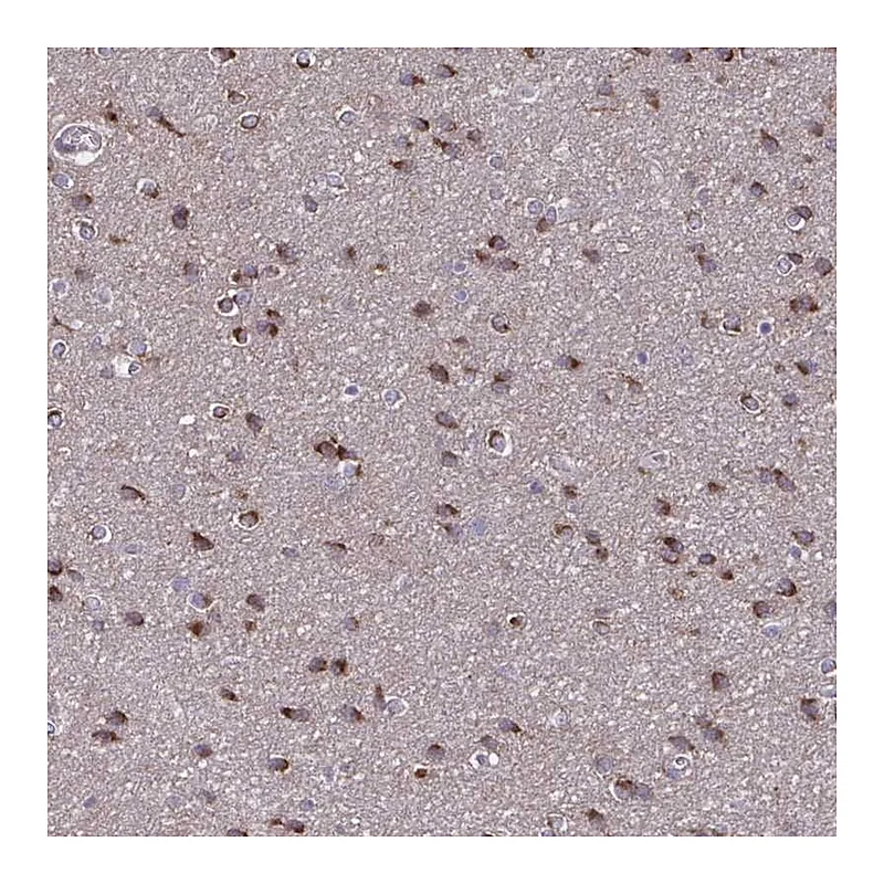 Atlas Antibodies Anti-NUMBL Antibody
