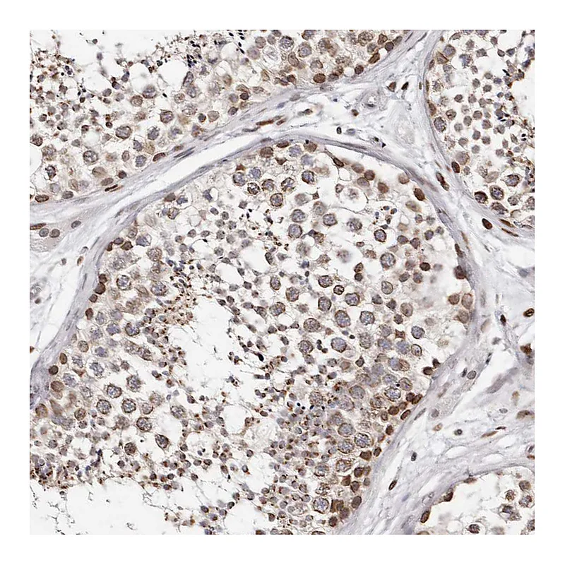 Atlas Antibodies Anti-NUP153 Antibody