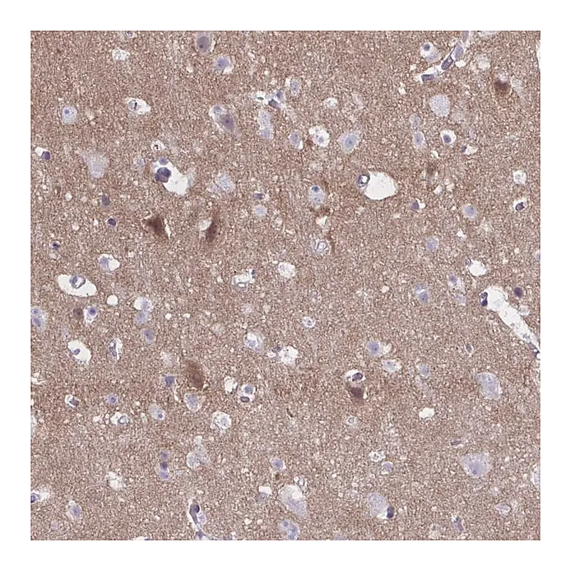 Atlas Antibodies Anti-NUMBL Antibody