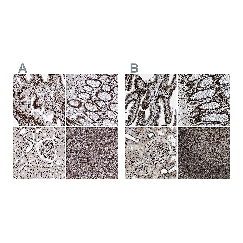 Atlas Antibodies Anti-NUMA1 Antibody